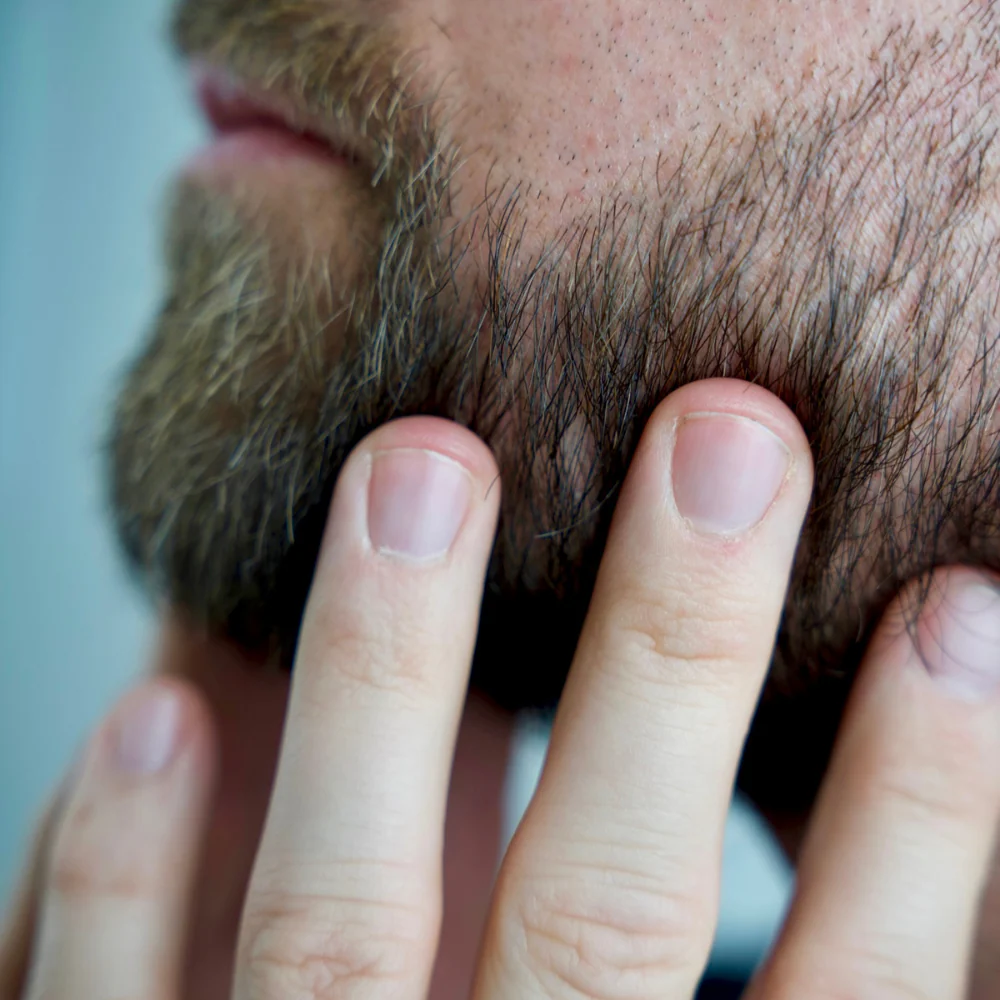 Magic Bald Head & Beard Oil 30ml - Image 4
